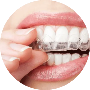 ホワイトニング